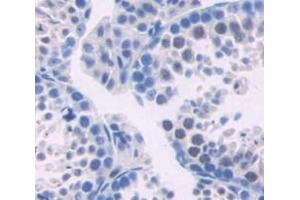 IHC-P analysis of testis tissue, with DAB staining. (TYMS anticorps  (AA 36-313))