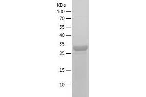 Western Blotting (WB) image for Tumor Necrosis Factor Receptor Superfamily, Member 10a (TNFRSF10A) (AA 379-445) protein (His-IF2DI Tag) (ABIN7125544)