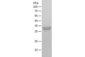 Western Blotting (WB) image for Tumor Necrosis Factor Receptor Superfamily, Member 10a (TNFRSF10A) (AA 379-445) protein (His-IF2DI Tag) (ABIN7125544)