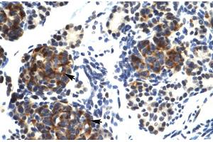 Human Pancreas (TRIM41 anticorps  (C-Term))