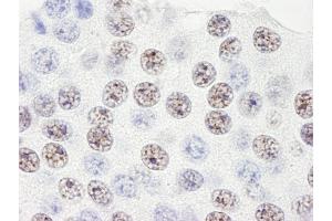 Immunohistochemistry (IHC) image for anti-Squamous Cell Carcinoma Antigen Recognized By T Cells 3 (SART3) (AA 600-650) antibody (ABIN7449020)