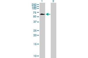 Western Blot analysis of ACD expression in transfected 293T cell line by ACD MaxPab polyclonal antibody.