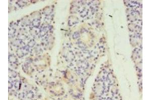 Immunohistochemistry of paraffin-embedded human pancreatic tissue using ABIN7170733 at dilution of 1:100