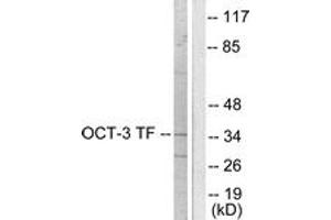 Western blot analysis of extracts from HeLa cells, using OCT3 Antibody. (SLC22A8 anticorps  (AA 191-240))