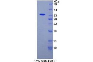 SDS-PAGE (SDS) image for Matrix Metallopeptidase 7 (Matrilysin, Uterine) (MMP7) (AA 1-267) protein (His tag) (ABIN2125825) (MMP7 Protein (AA 1-267) (His tag))