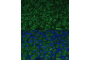 Immunofluorescence analysis of mouse pancreas using CTRB1 Polyclonal Antibody (ABIN7266398) at dilution of 1:100 (40x lens).