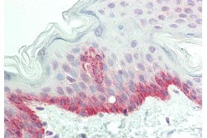Rabbit Anti-GFPT2 antibody  Formalin Fixed Paraffin Embedded Tissue: Human Skin Primary antibody Concentration: 1:100 Secondary Antibody: Donkey anti-Rabbit-Cy3 Secondary Antibody Concentration: 1:200 Magnification: 20x Exposure Time: 0.