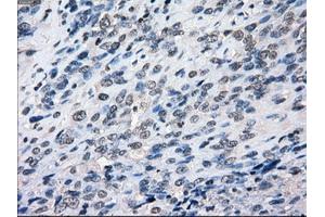 Image no. 4 for anti-Budding Uninhibited By Benzimidazoles 1 Homolog beta (Yeast) (BUB1B) antibody (ABIN1496995) (BUB1B anticorps)