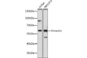 Western blot analysis of extracts of various cell lines, using Vimentin antibody (ABIN3016291, ABIN3016292, ABIN3016293 and ABIN6219693) at 1:500 dilution. (Vimentin anticorps  (AA 1-200))