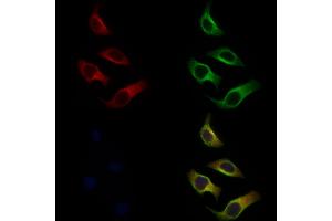 ABIN6256909 and ABIN6274864 staining Hela cells by IF/ICC.
