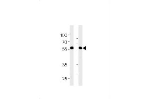 RFTN1 Antibody (Center) (ABIN1881746 and ABIN2843233) western blot analysis in MDA-MB-231,NCI- cell line lysates (35 μg/lane).