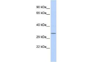 WB Suggested Anti-NMRAL1 Antibody Titration: 0. (NMRAL1 anticorps  (Middle Region))