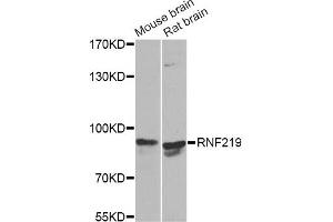 Western blot analysis of extracts of various cell lines, using RNF219 Antibody. (RNF219 anticorps)