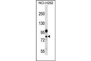 Western blot analysis of DDX3Y Antibody (N-term) in NCI-H292 cell line lysates (35ug/lane).