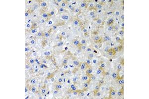 Immunohistochemistry of paraffin-embedded human liver injury using SRGN antibody (ABIN5974179) at dilution of 1/200 (40x lens). (SRGN anticorps)