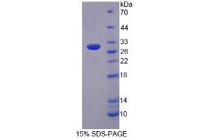 SDS-PAGE analysis of Mouse PTPRN2 Protein.