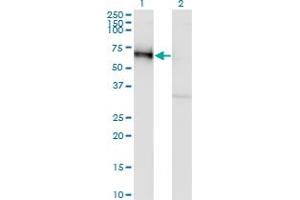 Western Blot analysis of GOLM1 expression in transfected 293T cell line by GOLM1 monoclonal antibody (M06A), clone 5B10.