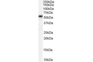 Western Blotting (WB) image for anti-Chromosome 20 Open Reading Frame 96 (C20ORF96) (N-Term) antibody (ABIN2791311) (C20ORF96 anticorps  (N-Term))