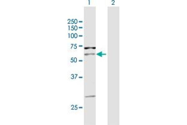 PIP5K1A Antikörper  (AA 1-500)