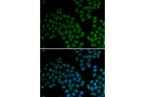 Immunofluorescence analysis of MCF7 cell using SOX2 antibody. (SOX2 anticorps  (AA 1-140))
