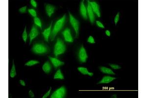 Immunofluorescence of purified MaxPab antibody to RPL29 on HeLa cell. (RPL29 anticorps  (AA 1-157))
