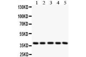 Anti- LOX1 antibody, Western blotting All lanes: Anti LOX1  at 0. (OLR1 anticorps  (Middle Region))