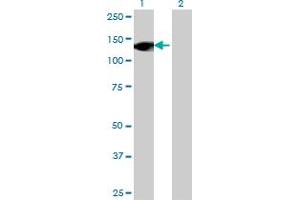 Western Blot analysis of RNF40 expression in transfected 293T cell line by RNF40 monoclonal antibody (M09), clone 1C1.