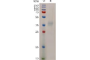 Human L1 Protein, His Tag on SDS-PAGE under reducing condition.
