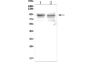Western blot analysis of TLR1 using anti-TLR1 antibody (ABIN7602194). (TLR1 anticorps  (AA 62-404))