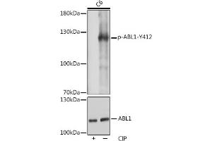 Western blot analysis of extracts of C6 cells, using Phospho-c-Abl-Y412 pAb (ABIN7265966) at 1:1000 dilution or  antibody (ABIN3020871, ABIN3020872, ABIN3020873 and ABIN6213767). (ABL1 anticorps  (pTyr412))