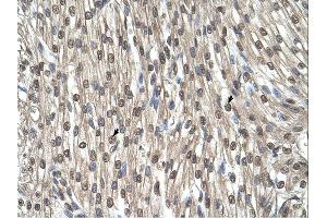 Immunohistochemistry (IHC) image for anti-serine Hydroxymethyltransferase 2 (Mitochondrial) (SHMT2) (C-Term) antibody (ABIN2782503)