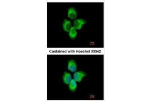 ICC/IF Image Immunofluorescence analysis of methanol-fixed A431, using MMP8, antibody at 1:500 dilution. (MMP8 anticorps)