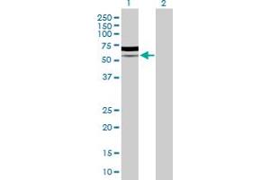 Western Blot analysis of PIK3R5 expression in transfected 293T cell line by PIK3R5 MaxPab polyclonal antibody.