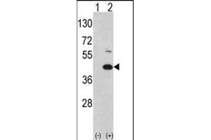 Western blot analysis of MOS (arrow) using rabbit polyclonal hMOS-R8 (ABIN392644 and ABIN2842147).