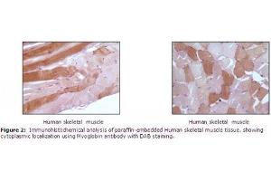 Image no. 1 for anti-Myoglobin (MB) antibody (ABIN207623) (Myoglobin anticorps)