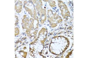 Immunohistochemistry of paraffin-embedded human stomach using NRG4 antibody (ABIN3016309, ABIN3016310, ABIN3016311 and ABIN6219713) at dilution of 1:100 (40x lens). (Neuregulin 4 anticorps  (AA 1-115))
