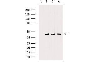 Western blot analysis of extracts from various samples, using PDHA1 Antibody. (PDHA1 anticorps  (C-Term))