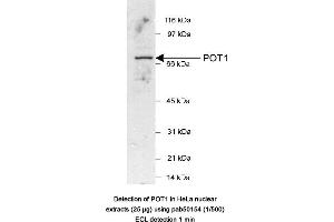 Image no. 1 for anti-Protection of Telomeres 1 (POT1) (AA 200-300) antibody (ABIN363463) (POT1 anticorps  (AA 200-300))