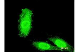 Immunofluorescence of monoclonal antibody to IRAK3 on HeLa cell. (IRAK3 anticorps  (AA 497-596))
