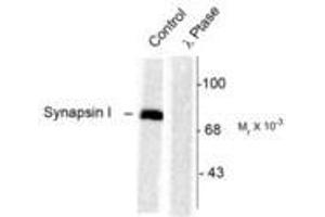 Image no. 1 for anti-Synapsin I (SYN1) (pSer603) antibody (ABIN227585) (SYN1 anticorps  (pSer603))