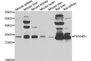 Western blot analysis of extracts of various cell lines, using PHYHD1 antibody (ABIN5974340) at 1/1000 dilution.