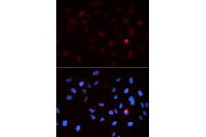 Immunofluorescence analysis of MCF-7 cells using Phospho-CDK1-T14 antibody (ABIN5969876). (CDK1 anticorps  (pThr14))