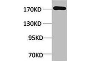 Western blot analysis of Rat Liver Tissue using EPG5 Polyclonal Antibody.