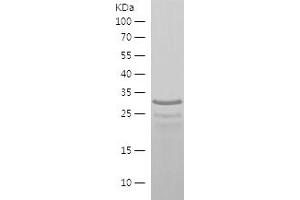 Western Blotting (WB) image for Acetyl LDL Receptor (SCARF1) (AA 623-830) protein (His tag) (ABIN7121638)