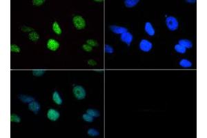 Immunofluorescence of Rabbit Anti-Histone H3 [Trimethyl Lys18] Antibody.