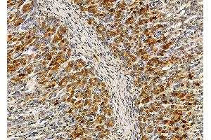 ABIN6263527 and ABIN6279597 at 1/100 staining rat stomach tissue by IHC-P.