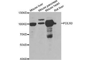 Western blot analysis of extracts of various cell lines, using PDE6B antibody. (PDE6B anticorps)