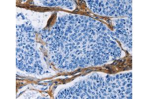 Immunohistochemistry (IHC) image for anti-Collagen, Type III, alpha 1 (COL3A1) antibody (ABIN2421422) (COL3A1 anticorps)
