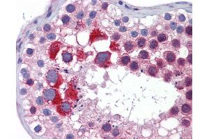 Anti-MTL5 antibody IHC of human testis.