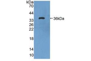 Figure. (FLT1 anticorps  (AA 18-308))